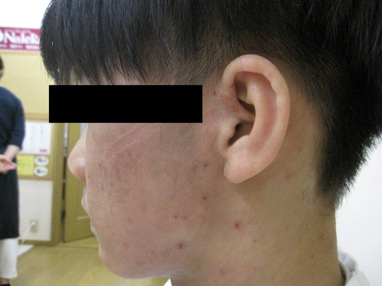 両方ありますか？